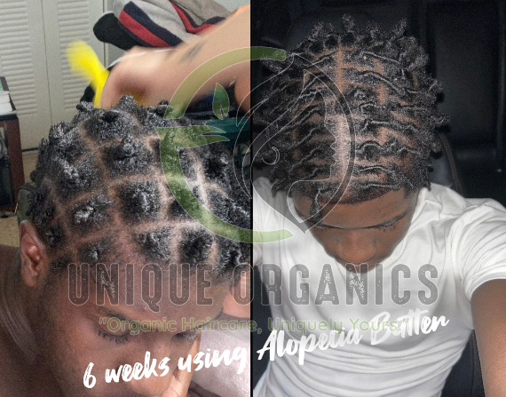 Moisturizing Alopecia Hair Cream With Clove, Fenugreek, Ginger and Moringa