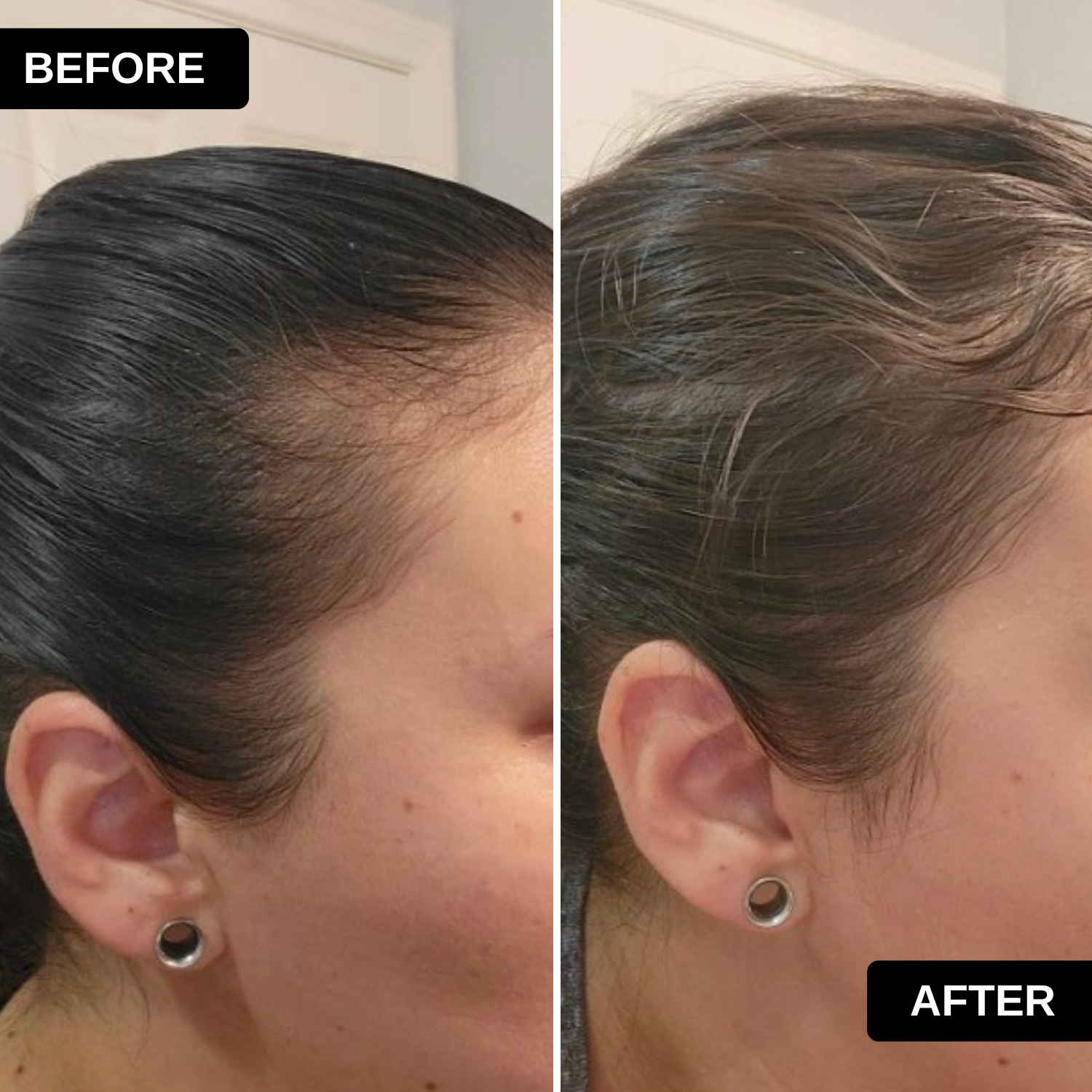 Ayurvedic Alopecia Hair Oil