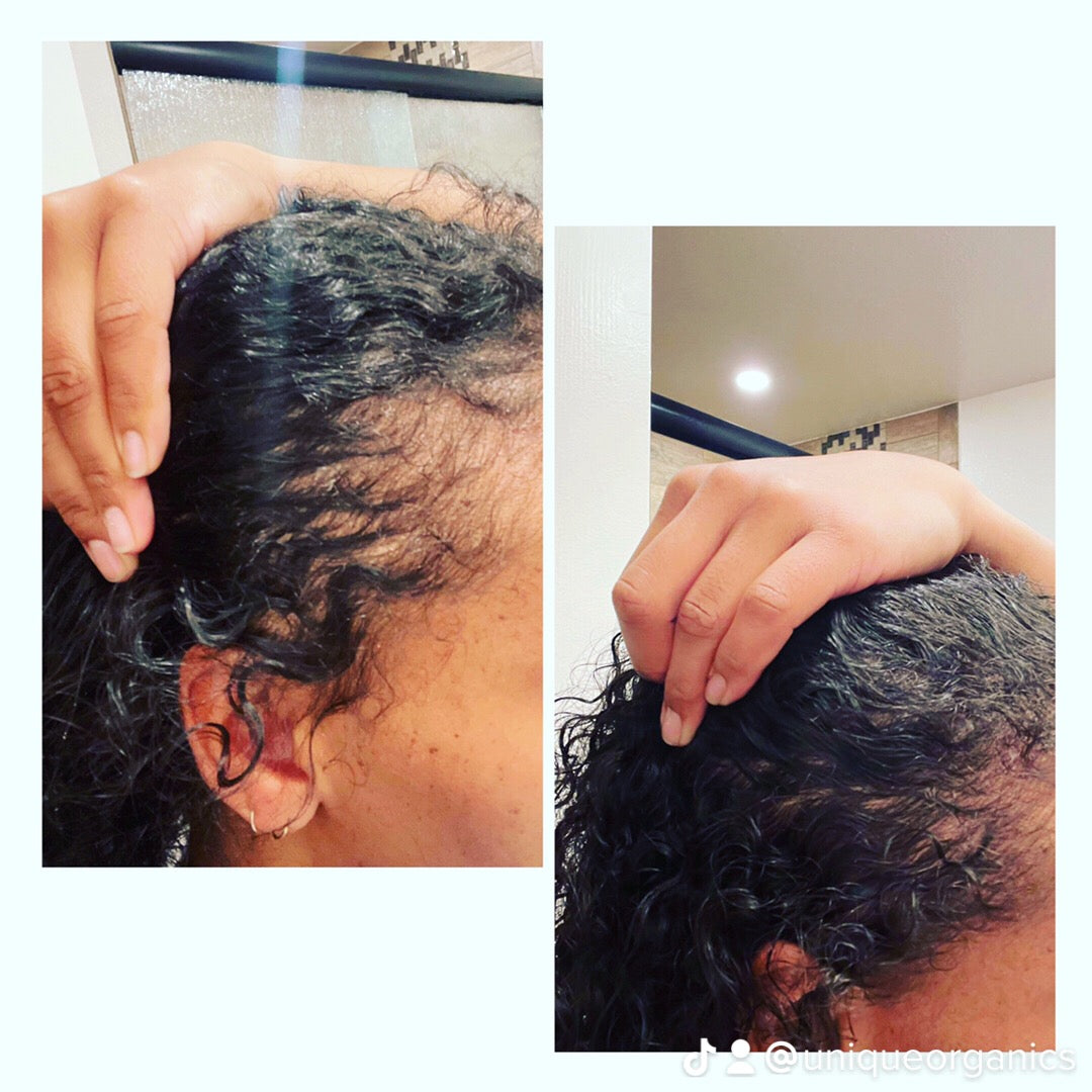 Organic Alopecia Hair Oil - Unique Organics  Haircare