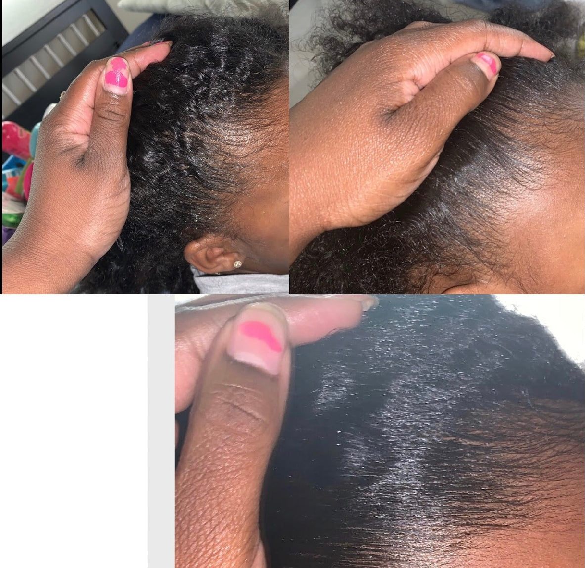Extra Strength Alopecia Hair Growth Oil - Unique Organics  Haircare