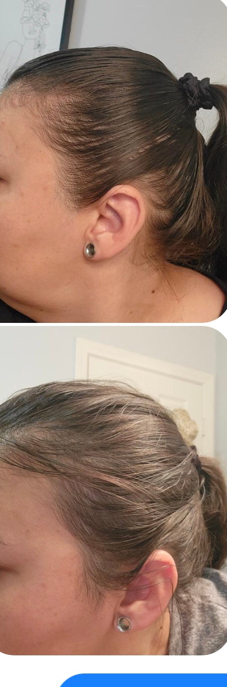 Organic Alopecia Hair Oil - Unique Organics  Haircare