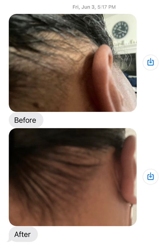 Extra Strength Alopecia Hair Growth Oil - Unique Organics  Haircare