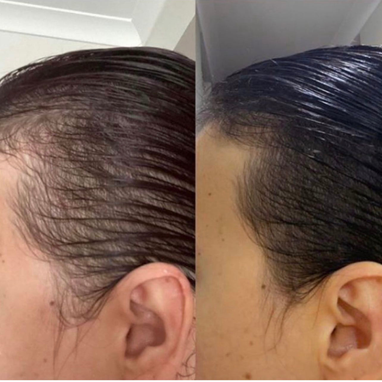 Organic Alopecia Hair Oil - Unique Organics  Haircare